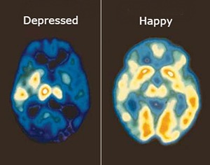 Happy and depressed brain scans